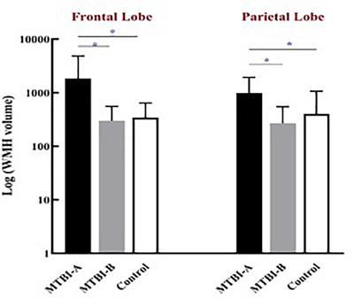 Frontal White Matter Hyperintensities Effect on Default Mode Network Connectivity in Acute Mild Traumatic Brain Injury